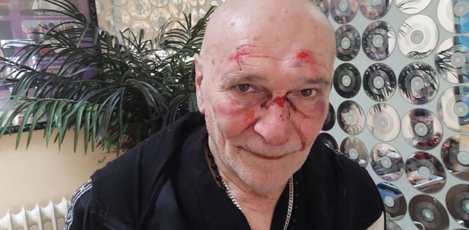 Peter Sebastian im Büro überfallen: Sänger erlitt Prellungen und Platzwunden